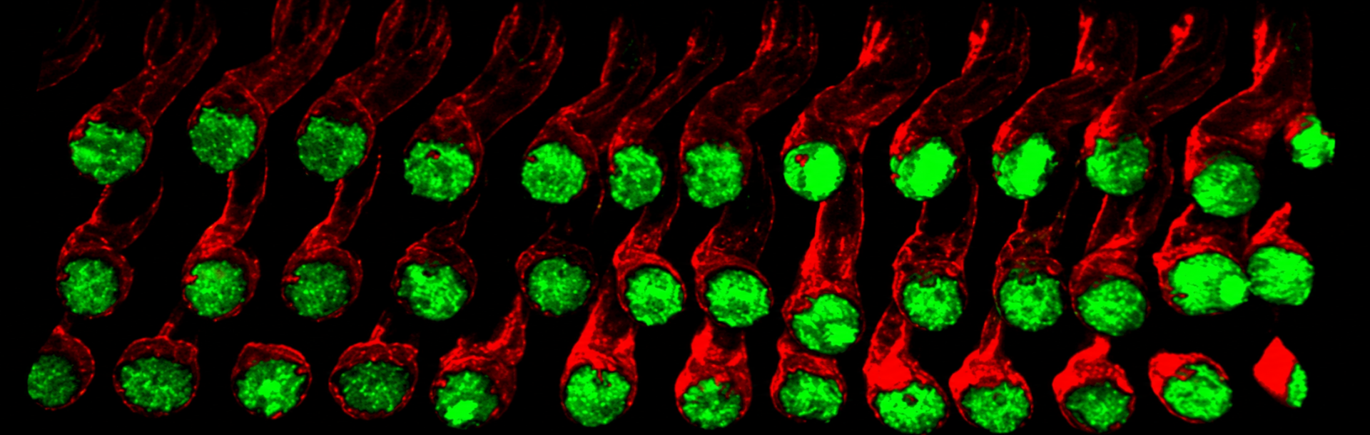 A study by Lama Khalaily and Prof. Karen B. Avraham uncovers rare inner ear cells that can regenerate hearing.