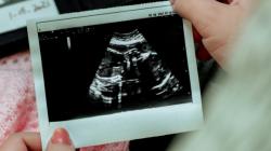 Artificial intelligence is not more accurate than doctors with clinical experience in high-risk pregnancy situations. Photo: Unsplash