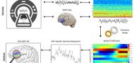 Neural and functional validation of fMRI-informed EEG model of right inferior frontal gyrus activity Neural and functional validation of fMRI-informed EEG model of right inferior frontal gyrus activity