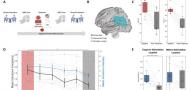 Hippocampal-network transcranial magnetic stimulation to target reactivated intrusive memories: A proof-of-concept study in PTSD treatment Hippocampal-network transcranial magnetic stimulation to target reactivated intrusive memories: A proof-of-concept study in PTSD treatment