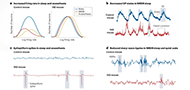 Linking activity dyshomeostasis and sleep disturbances in Alzheimer disease