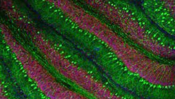 Mouse cerebellum